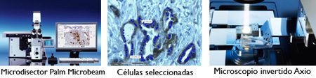 Inmunohistoquímica