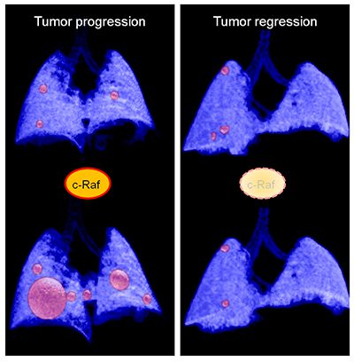 c-Raf ablation induces the regression of advanced lung tumours in mice
