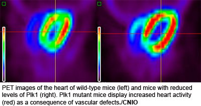 PET images of the heart of wild-type mice (left) and mice with reduced levels of Plk1 (right)