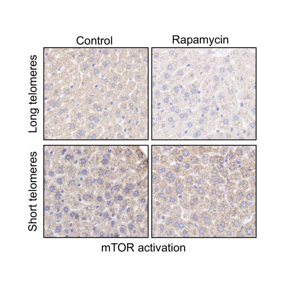 mTOR activity in mice liver samples
