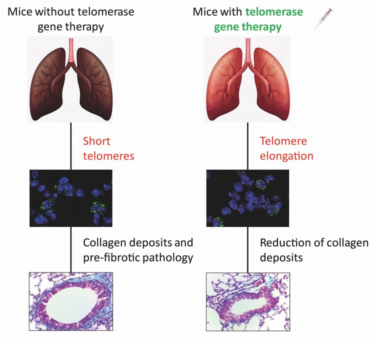 Gene therapy for reverse pulmonary fibrosis associated with ageing