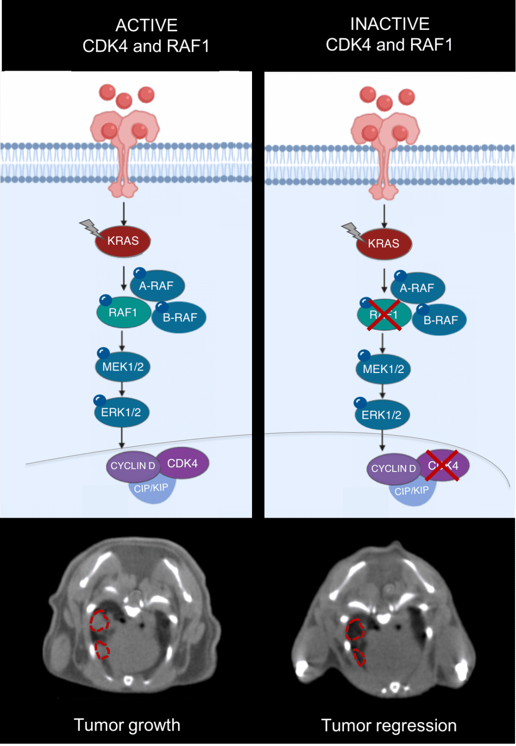 Illustration and Computed Tomography image of the therapeutic effect before and after CDK4 and RAF1 inactivation. On the left two tumors can be observed when KRAS is activating the downstream CDK4 and RAF1. On the right, the same tumours disappearing upon CDK4 and RAF1 inactivation. <b>/CNIO</b>