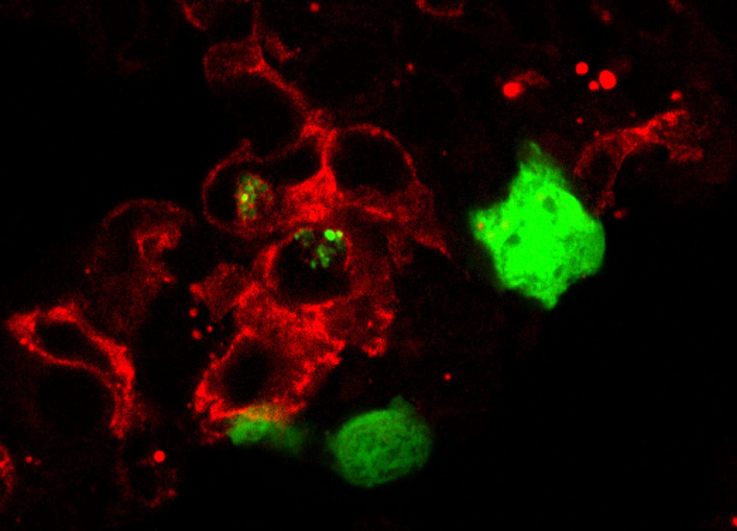 Macrófagos alveolares del pulmón (en rojo) fagocitando células tumorales (en verde). /Laboratorio de Miriam Merad, Icahn School of Medicine at Mount Sinai (ISMMS)