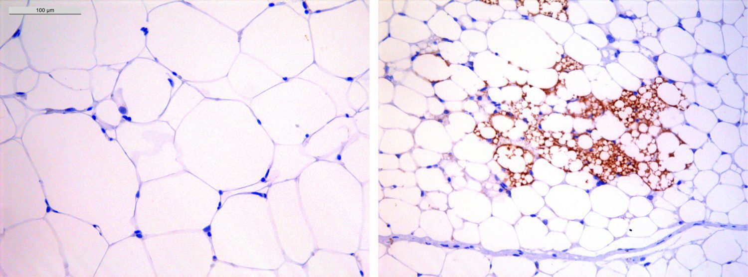 Visualization of adipocytes from an obese mouse (left) and from a lean mouse treated with digoxin (right), showing a better response to nutrient excess and burning of fat. /CNIO