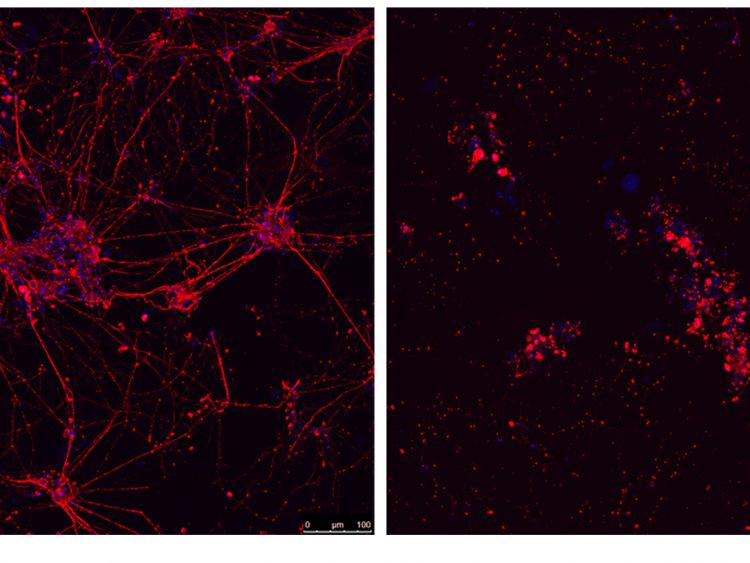 Neuronas motoras de ratón, CNIO