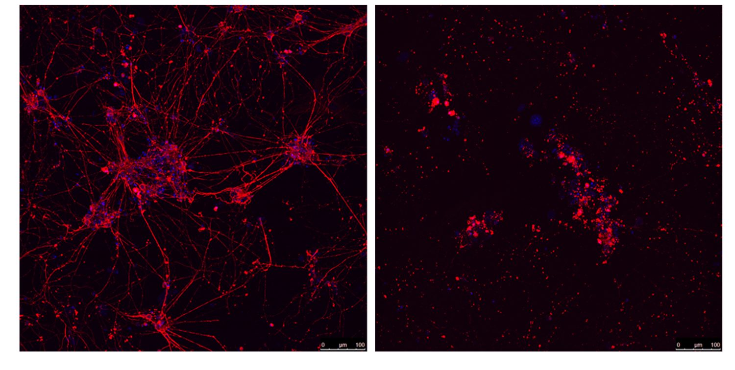 Neuronas motoras de ratón, expuestas (derecha) o no (izquierda) a los péptidos asociados a la ELA (derecha). Tal y como se observa en los pacientes, los péptidos son tóxicos y provocan la muerte de las neuronas. /CNIO