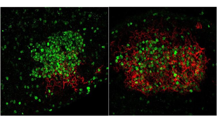 Centro germinal con estructura normal a la izquierda y aberrante por la falta de NGFR a la derecha. Los linfocitos B en proceso de maduración se muestran en verde y las células que generan la estructura en rojo. /Alberto Hernandez. CNIO