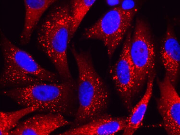 Fluorescence microscopy visualization of melanoma cells.