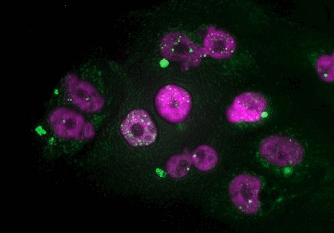 Pancreatic adenocarcinoma cells / CNIO