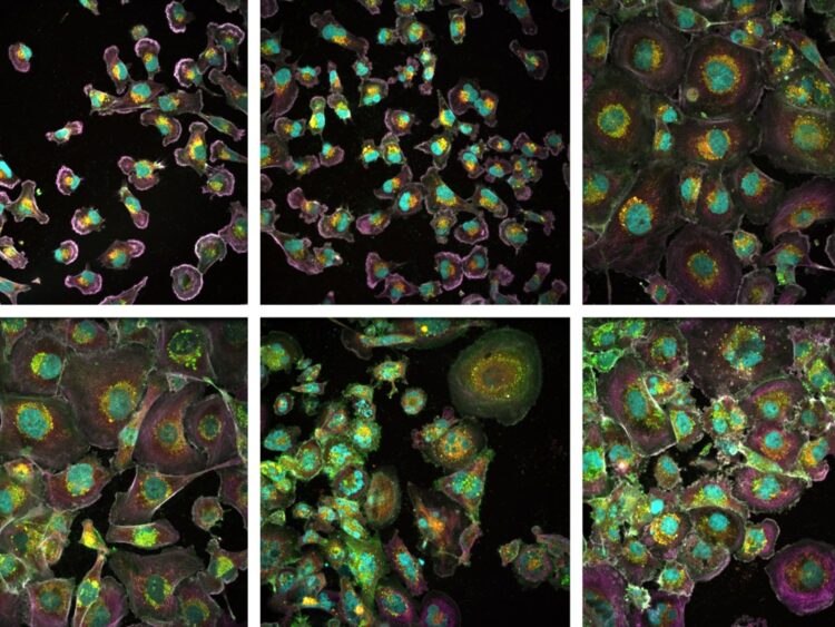 Células de cáncer de mama MDA-MB-231/ Unidad de Microscopía Confocal CNIO