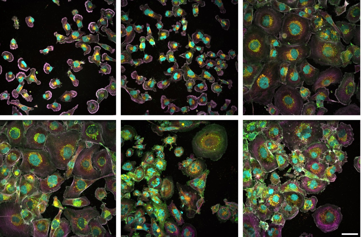 Células de cáncer de mama MDA-MB-231/ Unidad de Microscopía Confocal CNIO